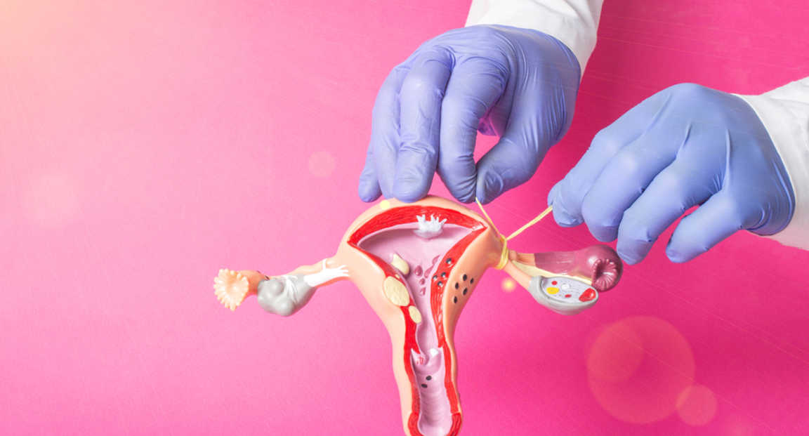 Egyre több nő sterilizáltatja magát egy gyerekmentes életért cserébe